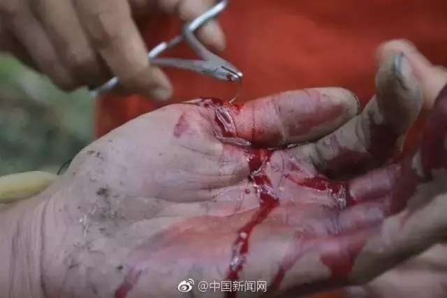 深度打击，当现实的伤口被剧情温柔剖开